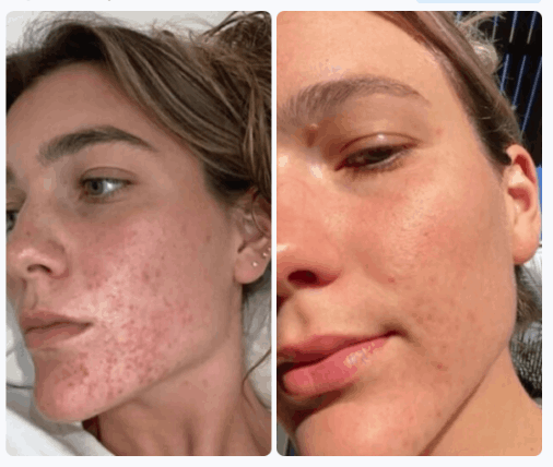 Clarexin Parasite Cleanse customer–Sophie D. 26 y.o.. Washington, USA